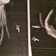 X-rays of Ross’s tased hand